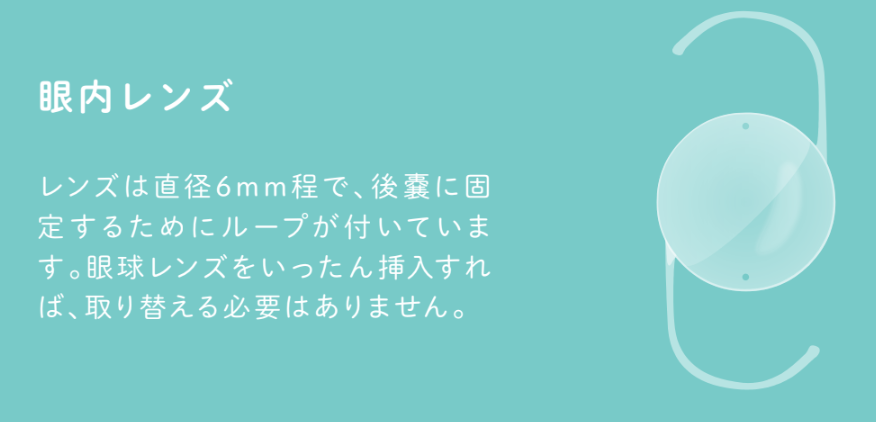 眼内レンズ：レンズは直径6mm程で、後嚢に固定するためにループが付いています。眼球レンズをいったん挿入すれば、取り替える必要はありません。