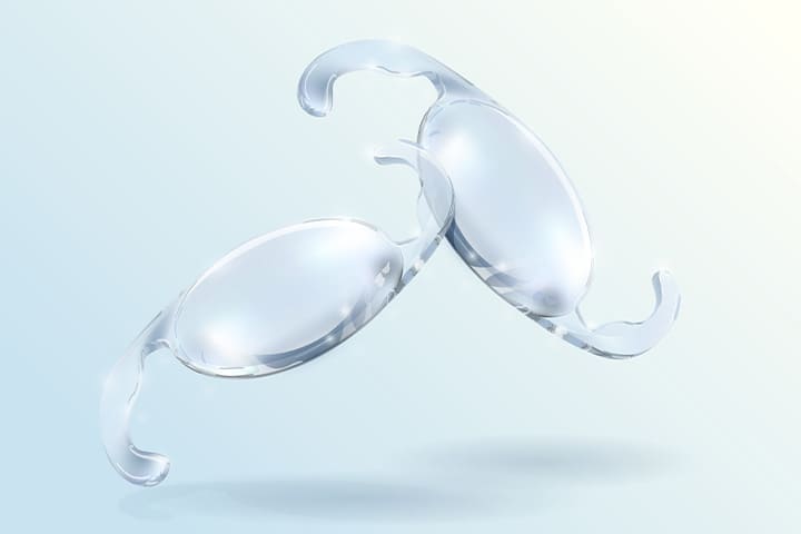 豊富な眼内レンズ